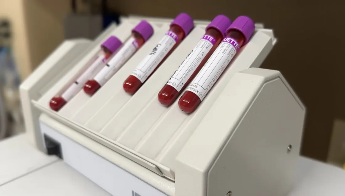 Blood samples in a rack, ready for in-house laboratory analysis