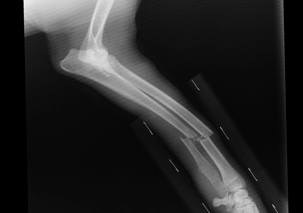 An X-ray of a dog's front leg showing a fracture of the radius and ulna